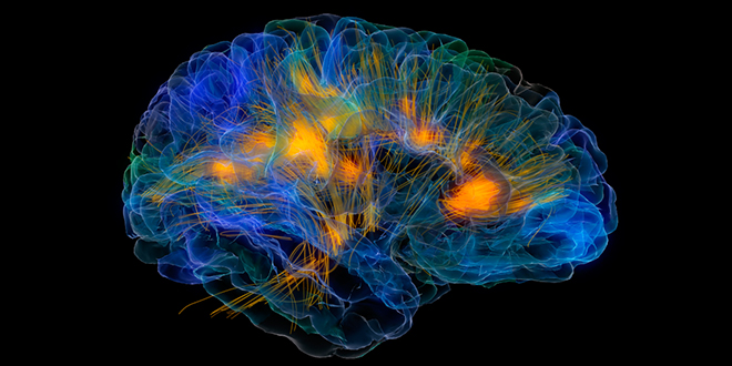 cerebro (1)